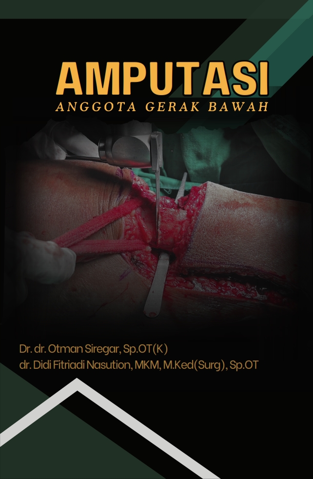Cover of Amputasi Anggota Gerak Bawah