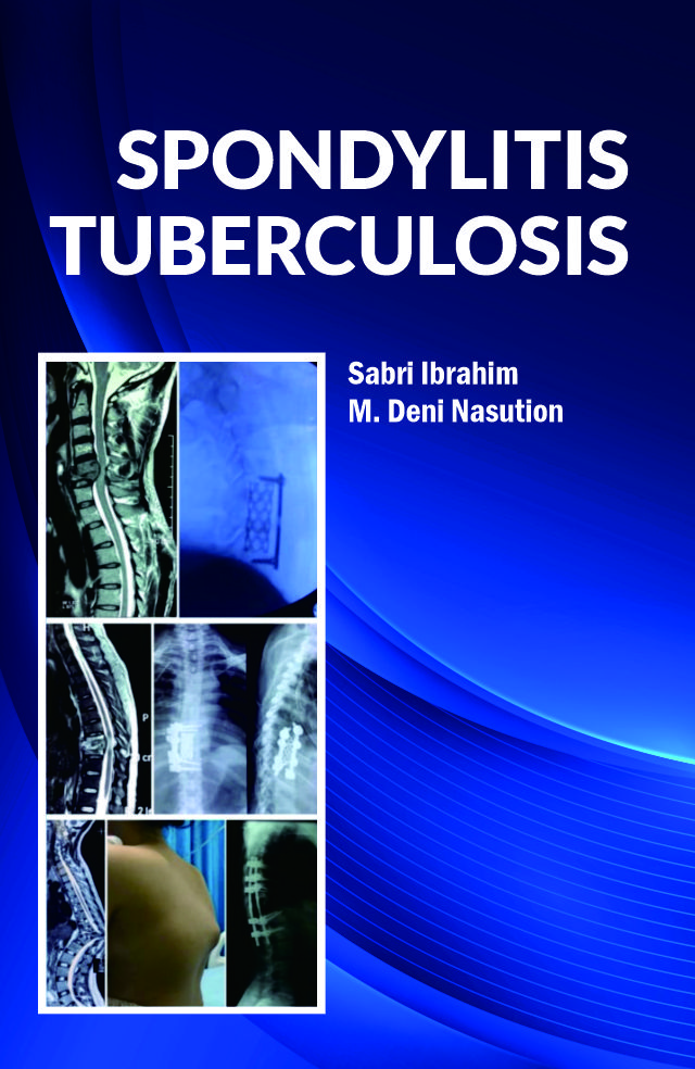 Cover of Spondylitis Tuberculosis