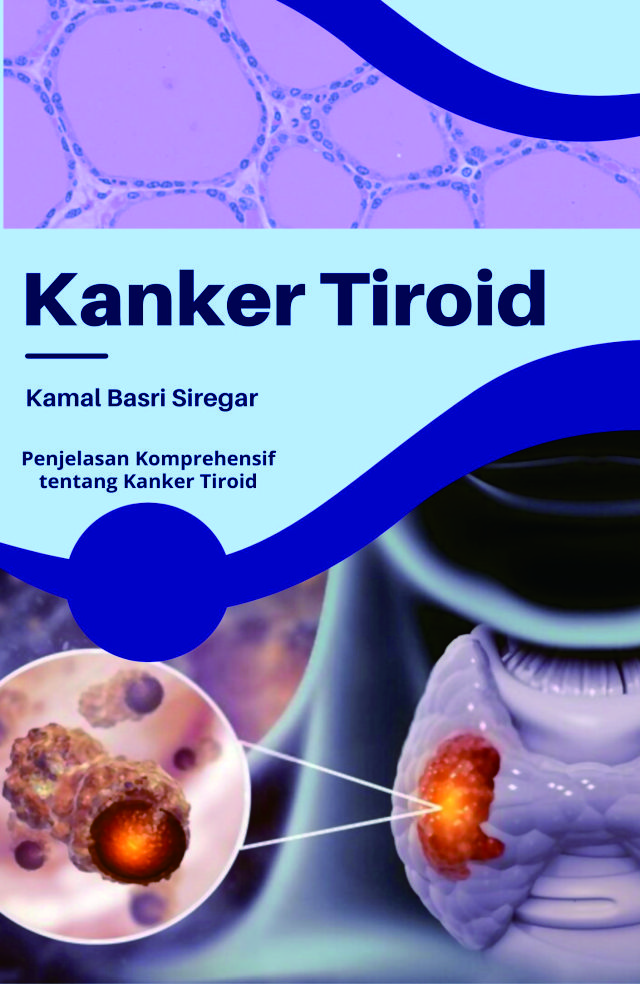 Cover of Kanker Tiroid: Penjelasan Komprehensif tentang Kanker Tiroid